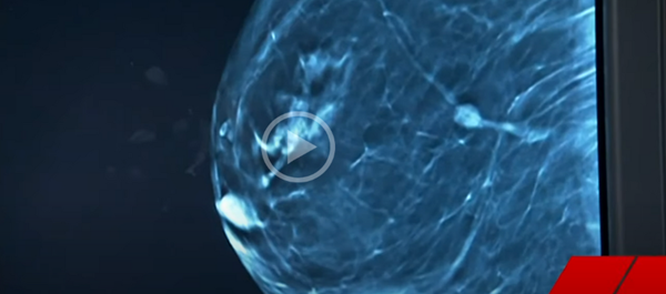 Breast-cancer-scan2.png